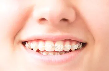 マルチブラケット装置